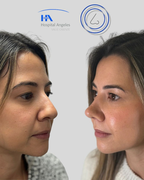 Slider image (3) Dr. Guillermo Guerra Gil de Leyva - Rhinoplasty Specialist